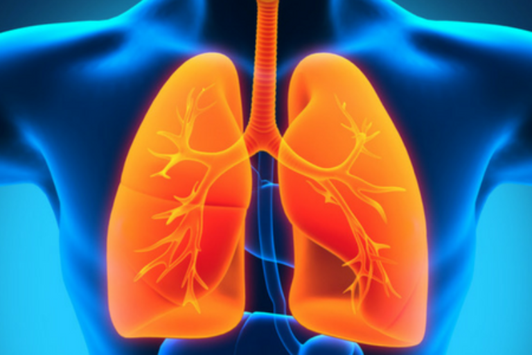 Respiratory Disorders